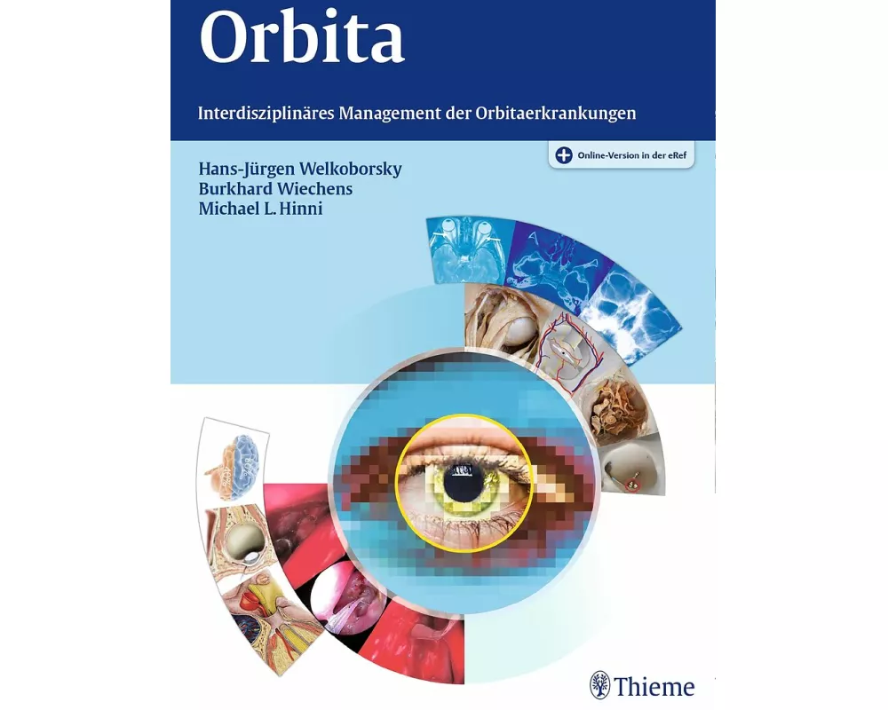 Orbita