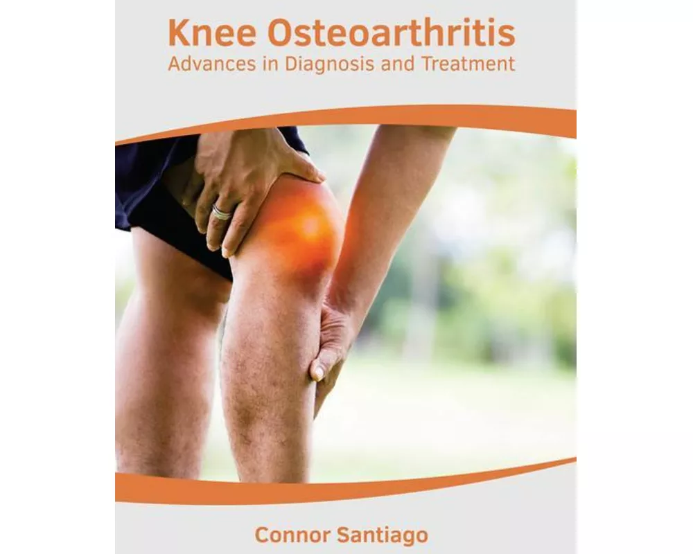 Knee Osteoarthritis: Advances in Diagnosis and Treatment