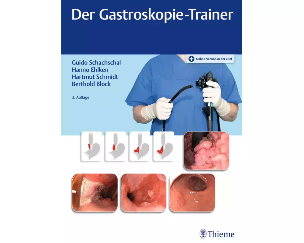 Der Gastroskopie-Trainer