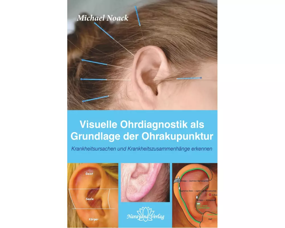 Visuelle Ohrdiagnostik als Grundlage der Ohrakupunktur