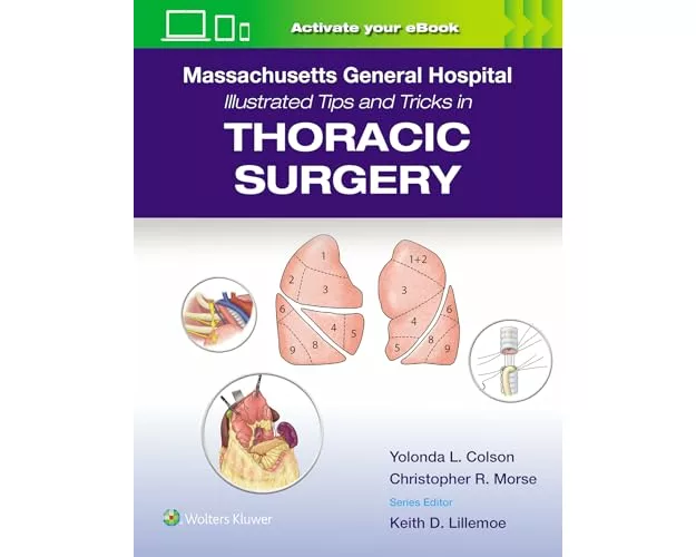 Massachusetts General Hospital Illustrated Tips and Tricks in Thoracic Surgery: Print + eBook with Multimedia