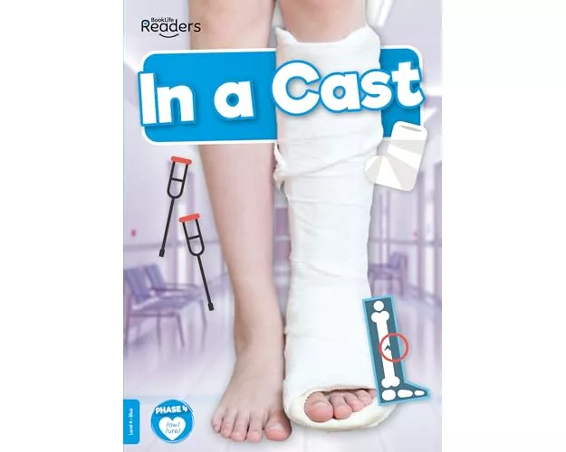 In a Cast