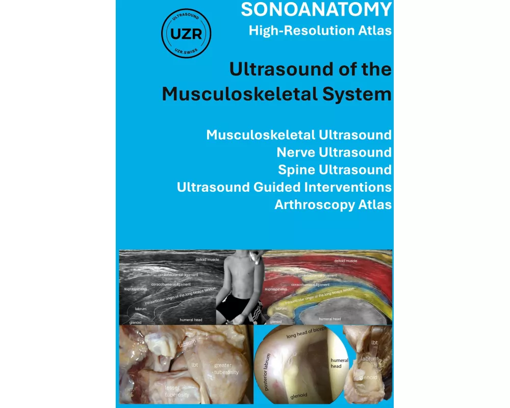 SONOANATOMY - High-Resolution Atlas - Ultrasound of the Musculoskeletal System