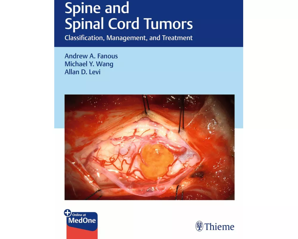Spine and Spinal Cord Tumors
