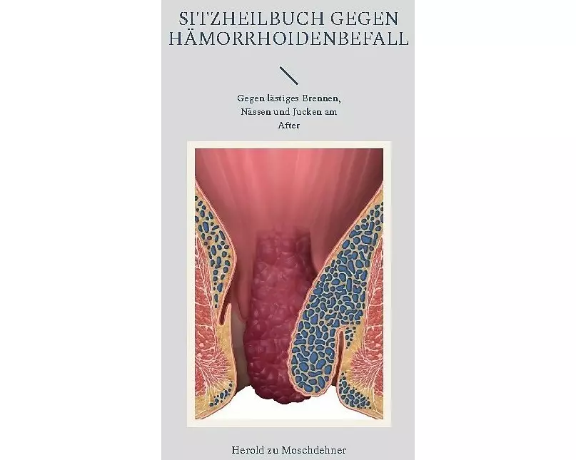 Sitzheilbuch gegen Hämorrhoidenbefall