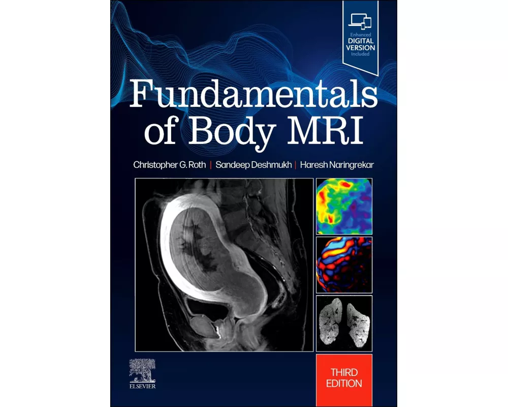 Fundamentals of Body MRI
