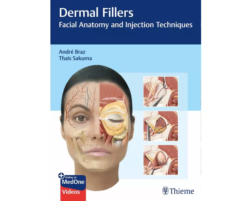 Dermal Fillers
