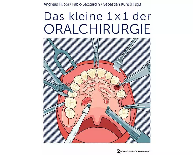 Das kleine 1 × 1 der Oralchirurgie