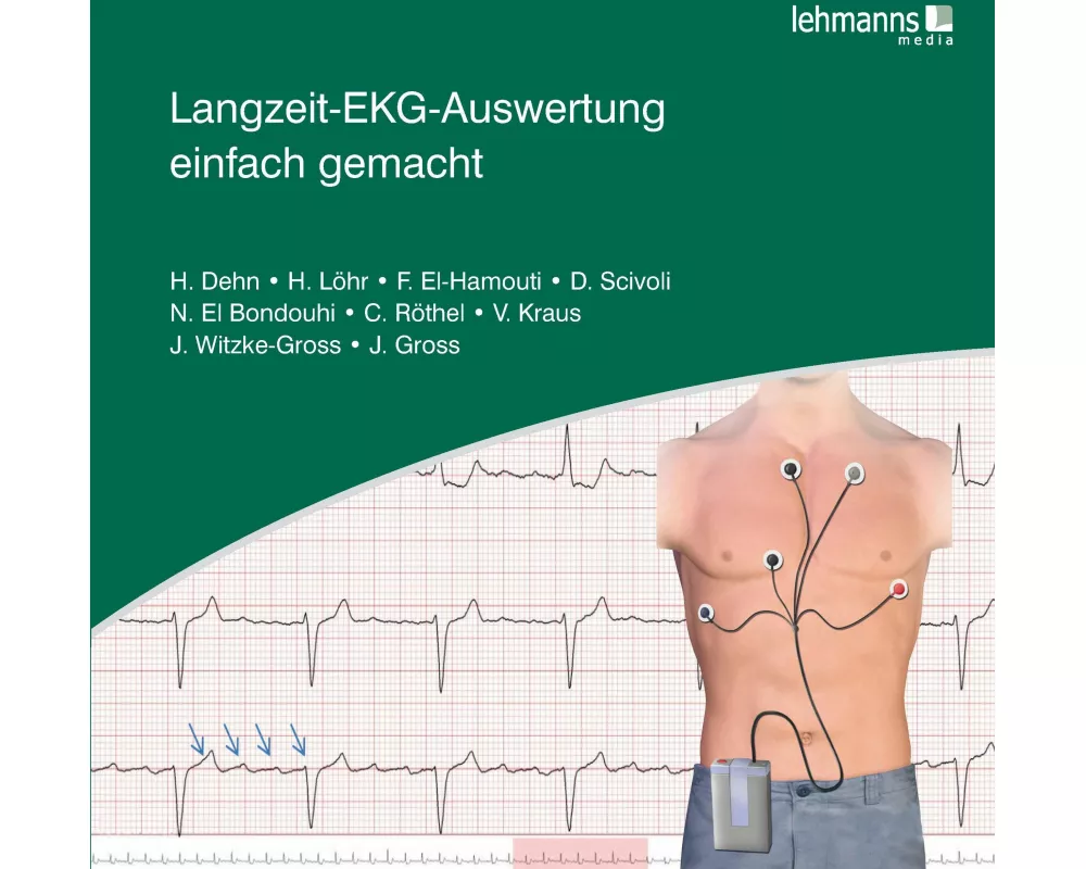 Langzeit-EKG-Auswertung einfach gemacht