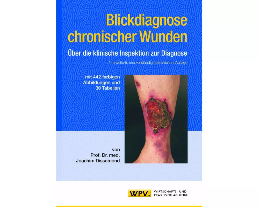 Blickdiagnose chronischer Wunden