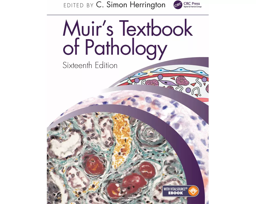 Muir's Textbook of Pathology