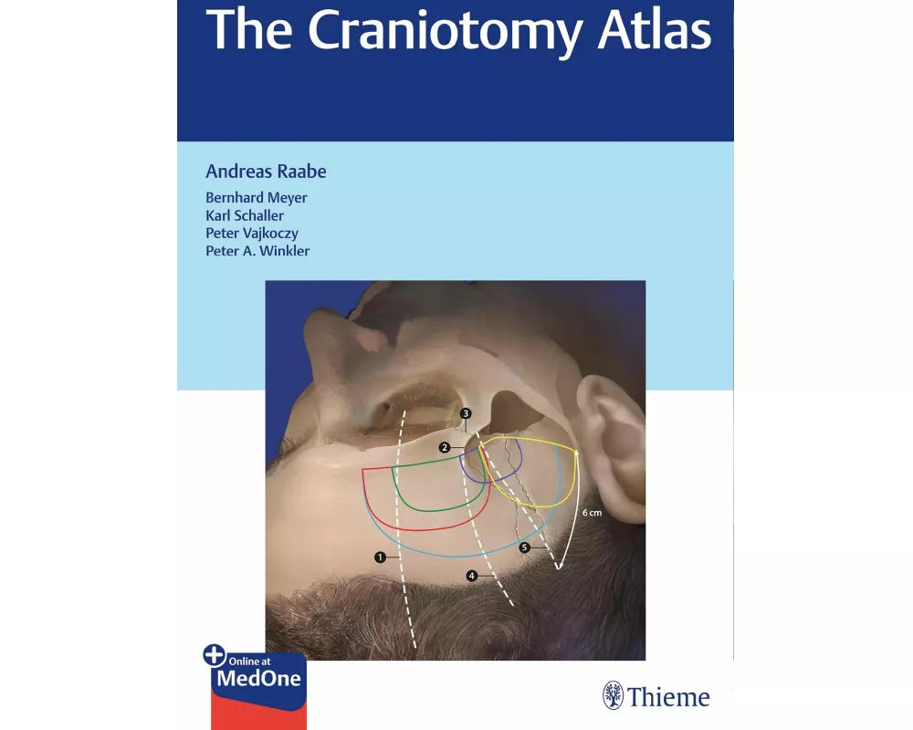 The Craniotomy Atlas