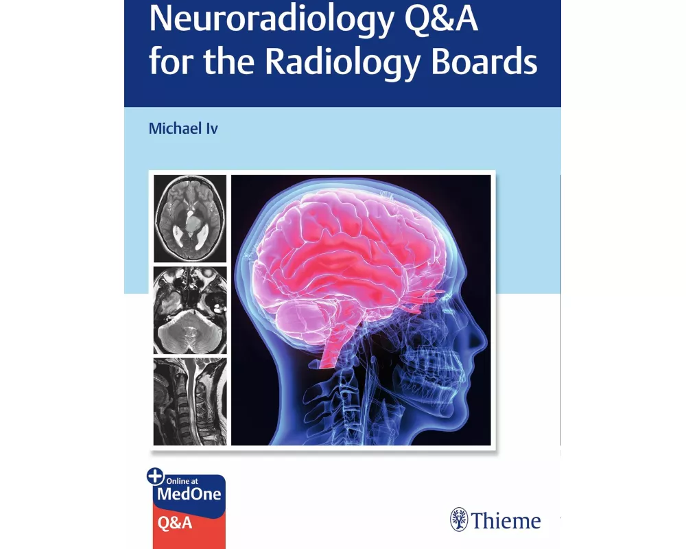 Neuroradiology Q&A for the Radiology Boards