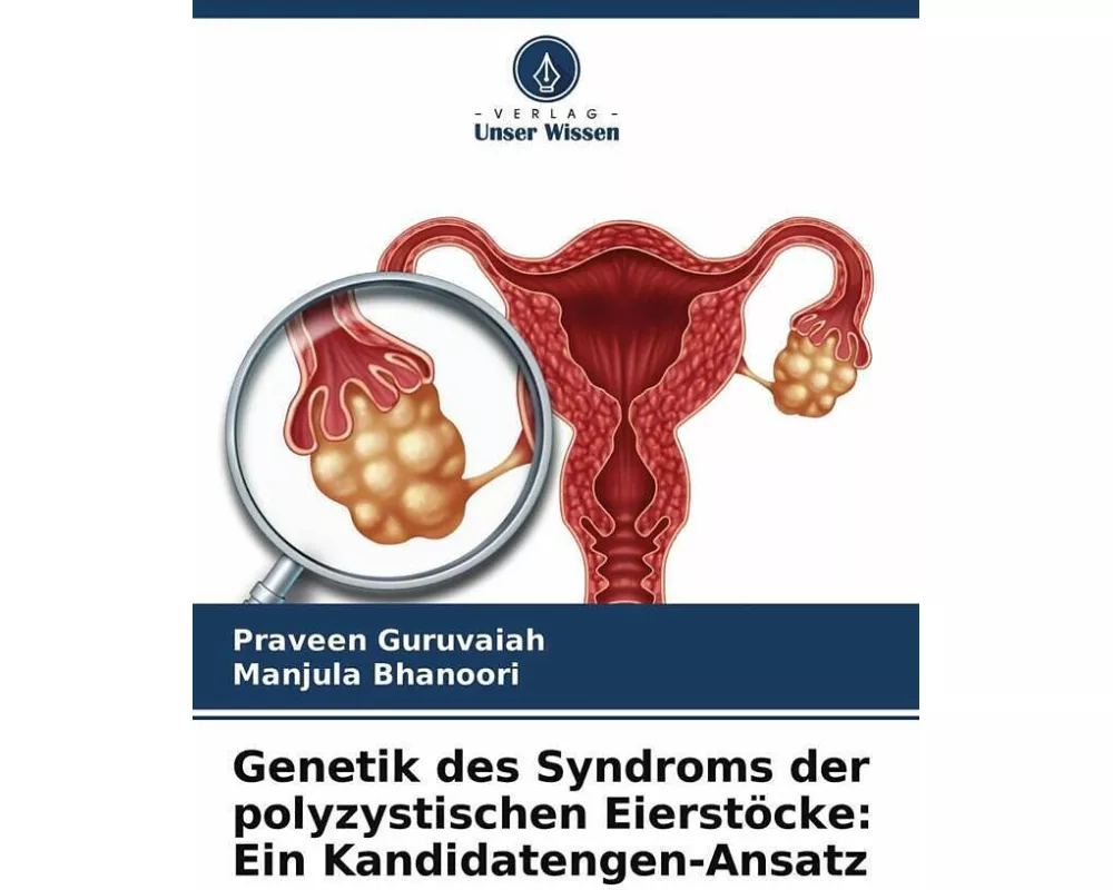 Genetik des Syndroms der polyzystischen Eierstöcke: Ein Kandidatengen-Ansatz