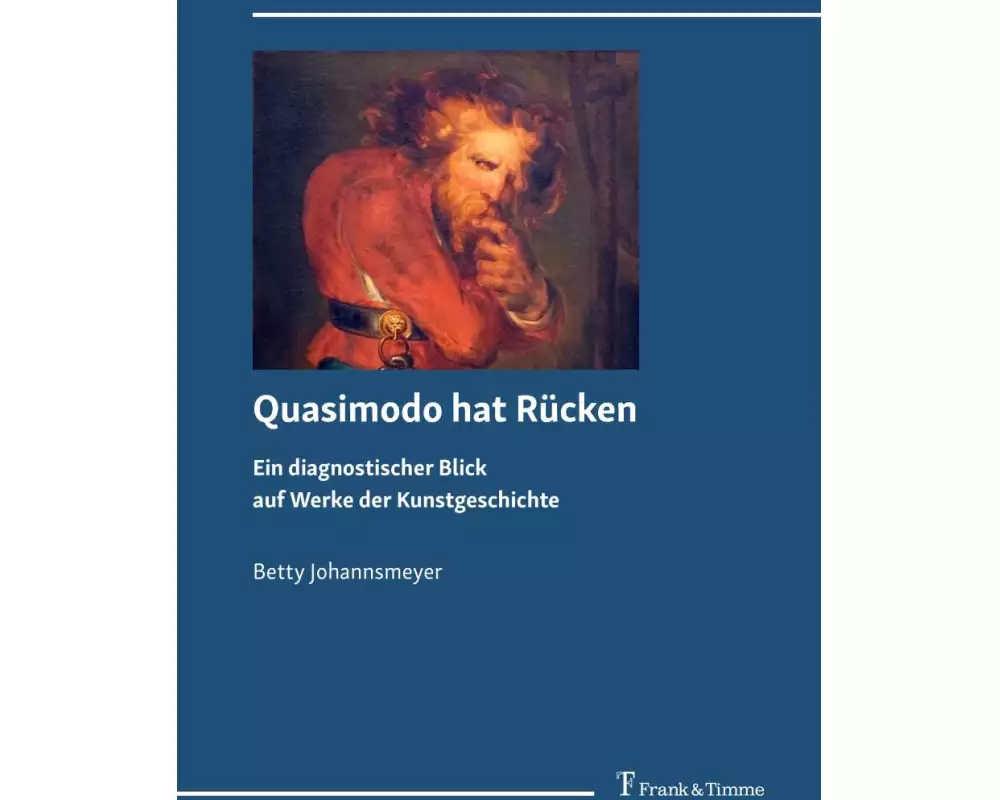 Quasimodo hat Rücken