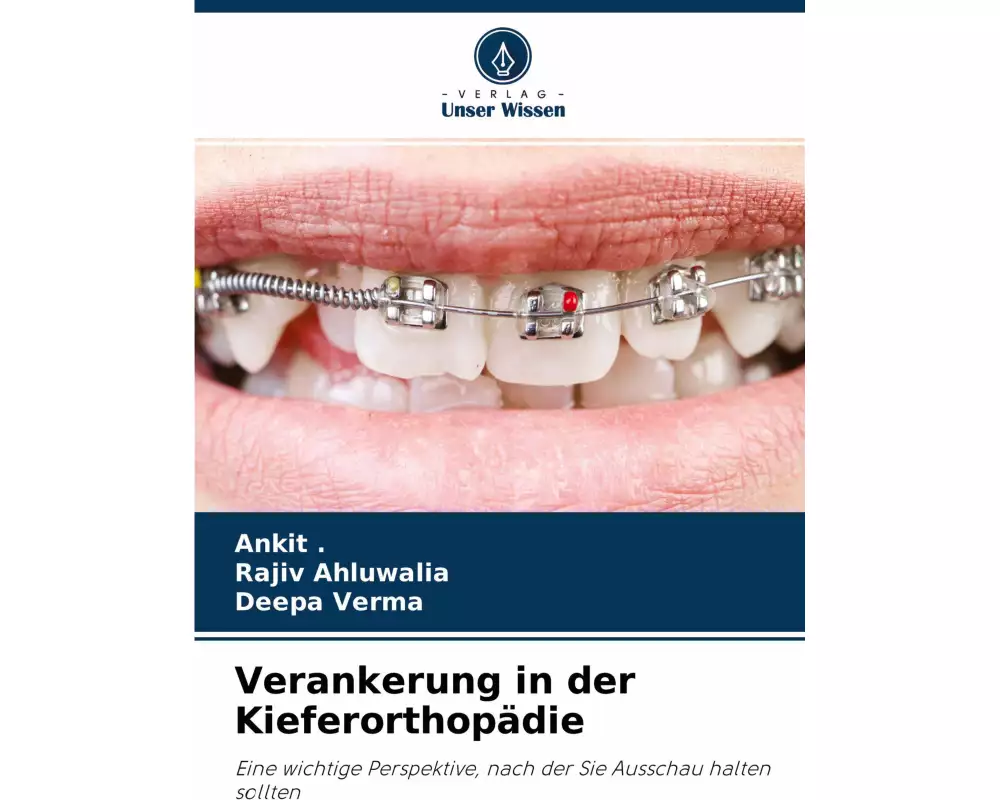 Verankerung in der Kieferorthopädie