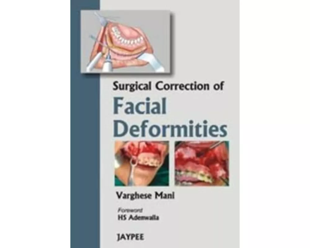 Surgical Correction of Facial Deformities