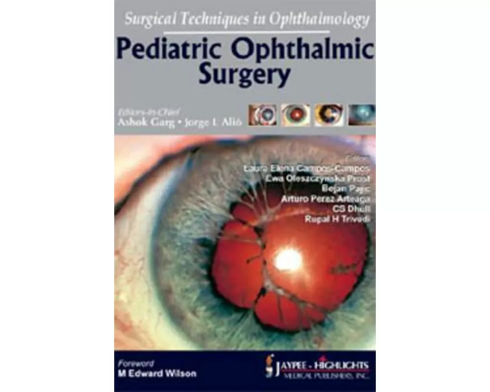 Surgical Techniques in Ophthalmology