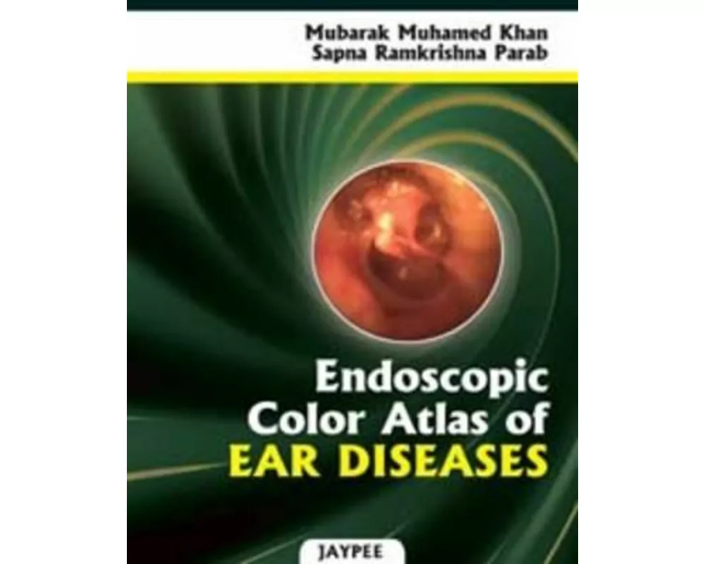 Endoscopic Color Atlas of Ear Diseases
