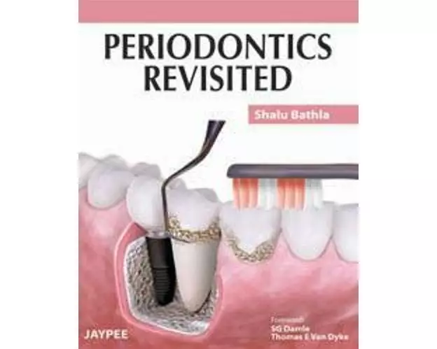 Periodontics Revisited