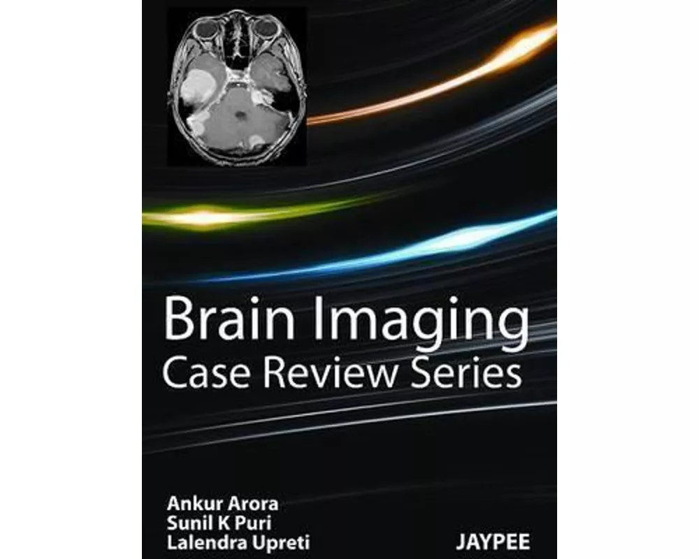 Brain Imaging
