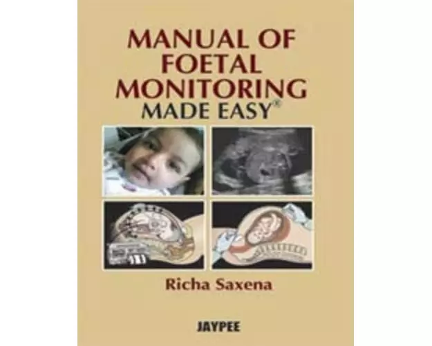 Manual of Fetal Monitoring Made Easy