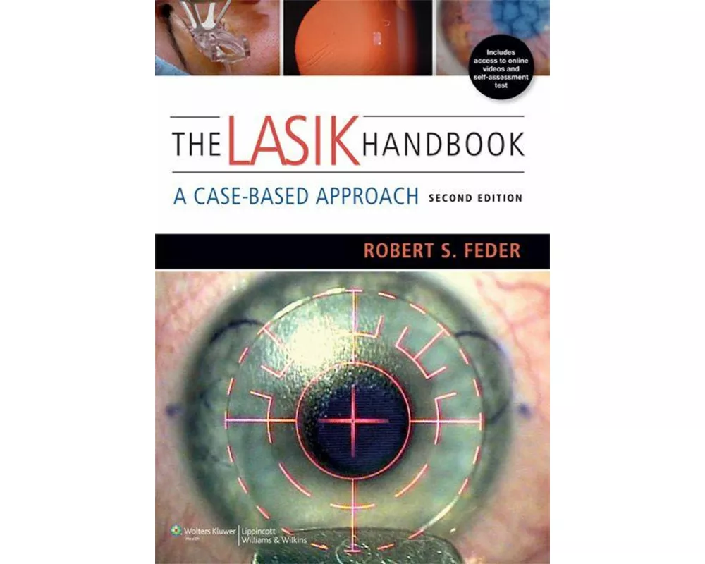The LASIK Handbook
