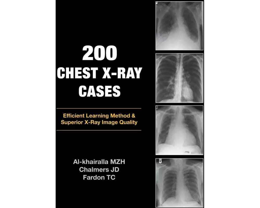 200 Chest X-Ray Cases