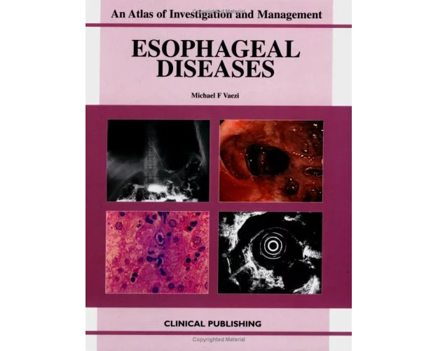 Esophageal Diseases