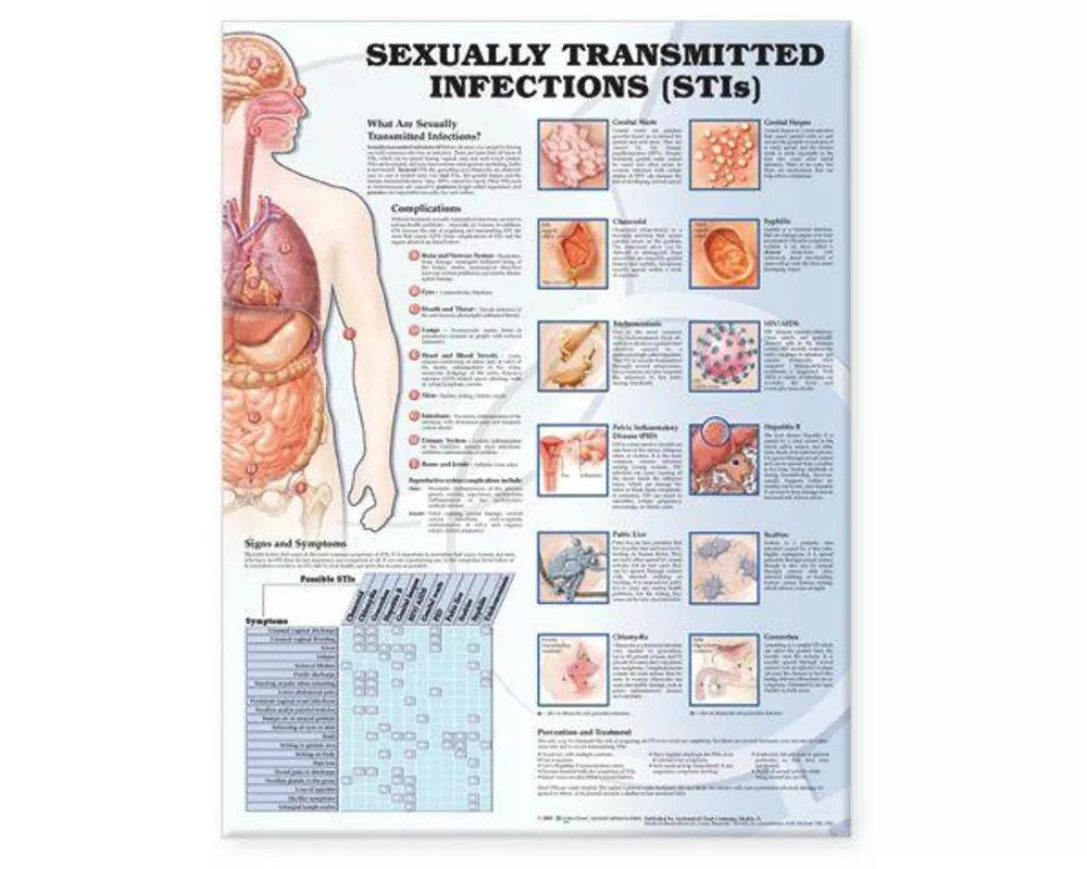 Sexually Transmitted Infections Anatomical Chart