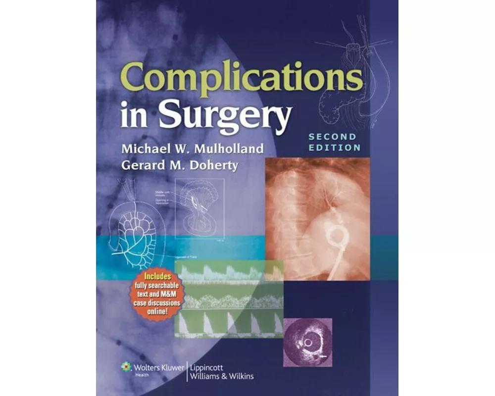 Complications in Surgery