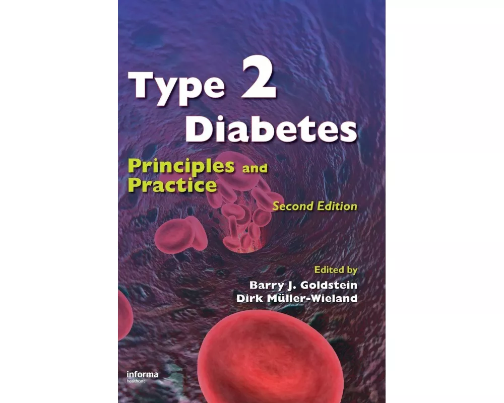 Type 2 Diabetes