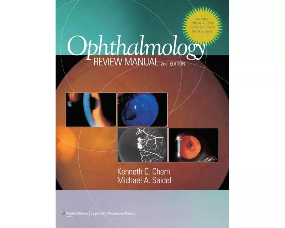 Ophthalmology Review Manual
