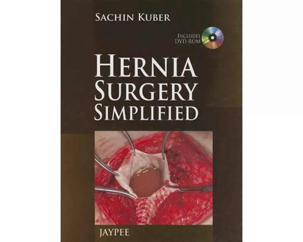 Hernia Surgery Simplified