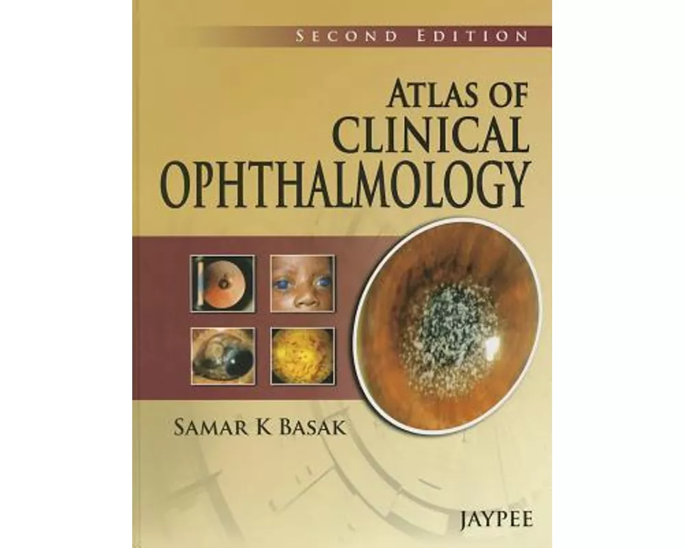 Atlas of Clinical Ophthalmology