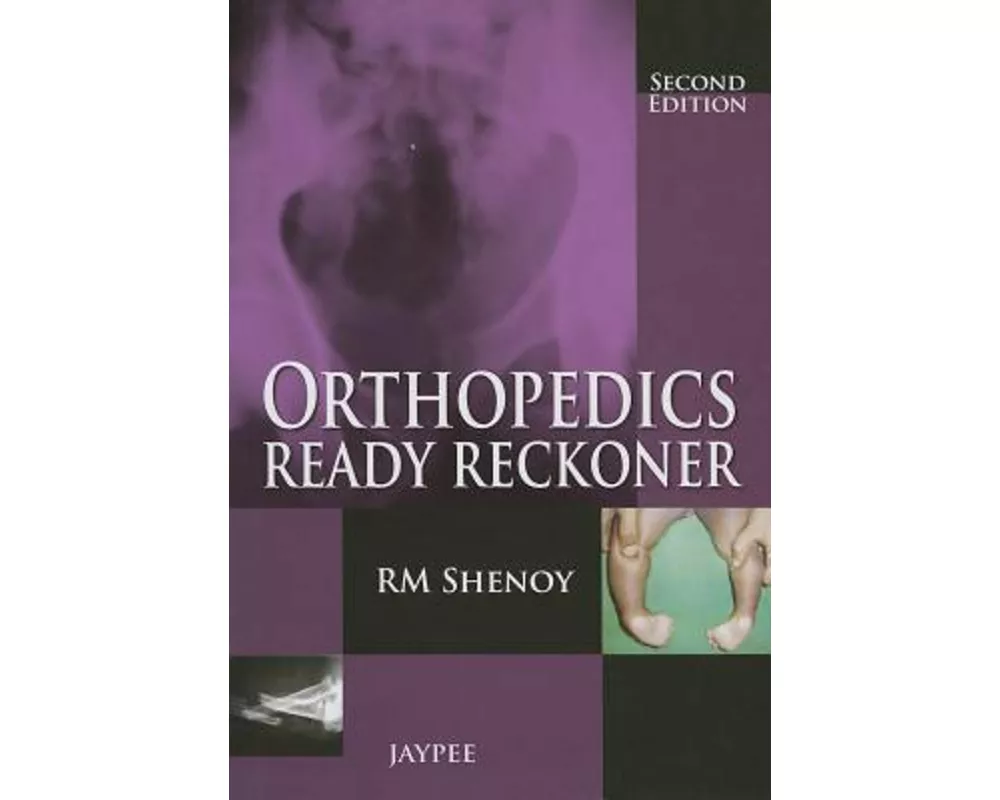 Orthopedics Ready Reckoner