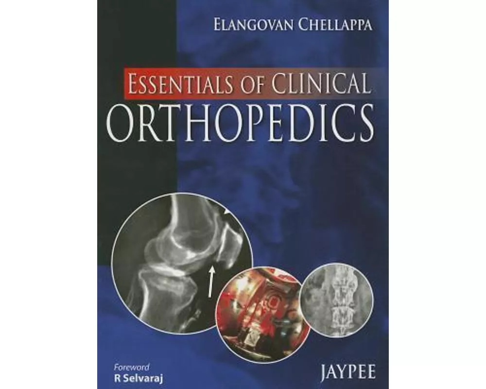 Essentials of Clinical Orthopedics