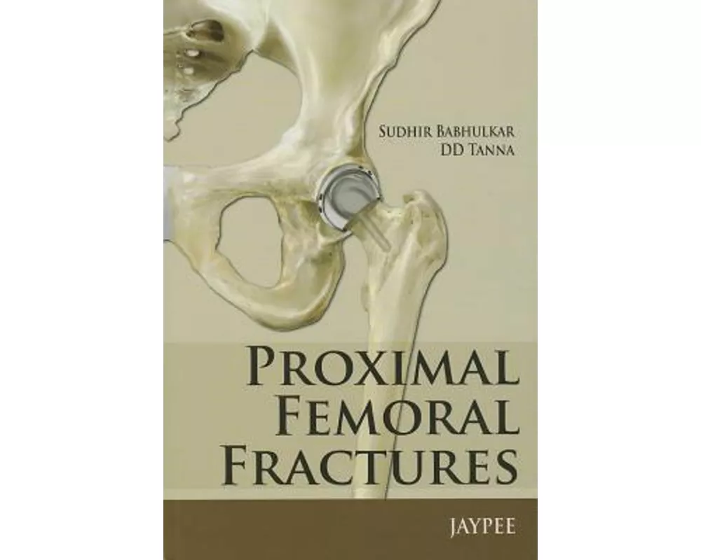 Proximal Femoral Fractures