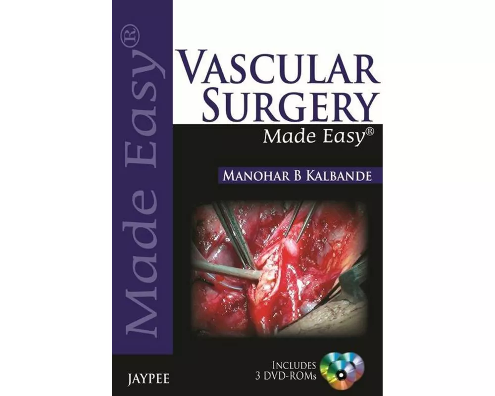 Vascular Surgery Made Easy