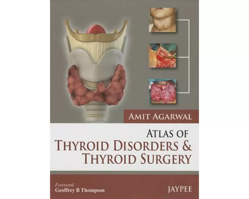 Atlas of Thyroid Disorders and Thyroid Surgery