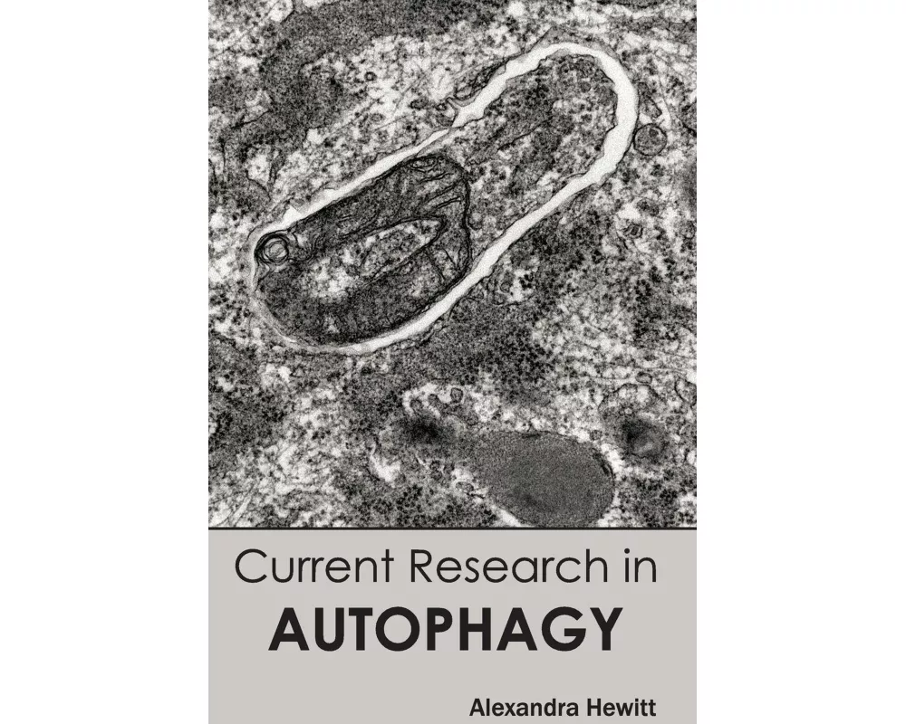 Current Research in Autophagy