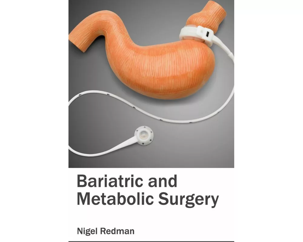 Bariatric and Metabolic Surgery