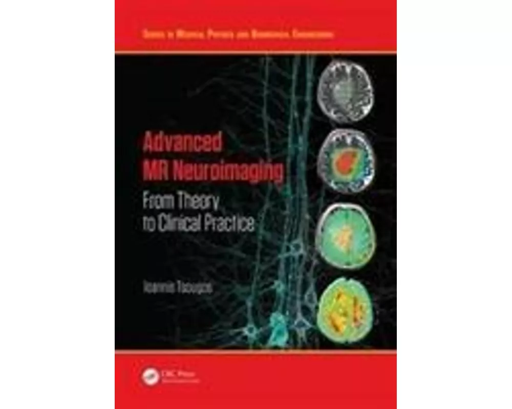 Advanced Mr Neuroimaging