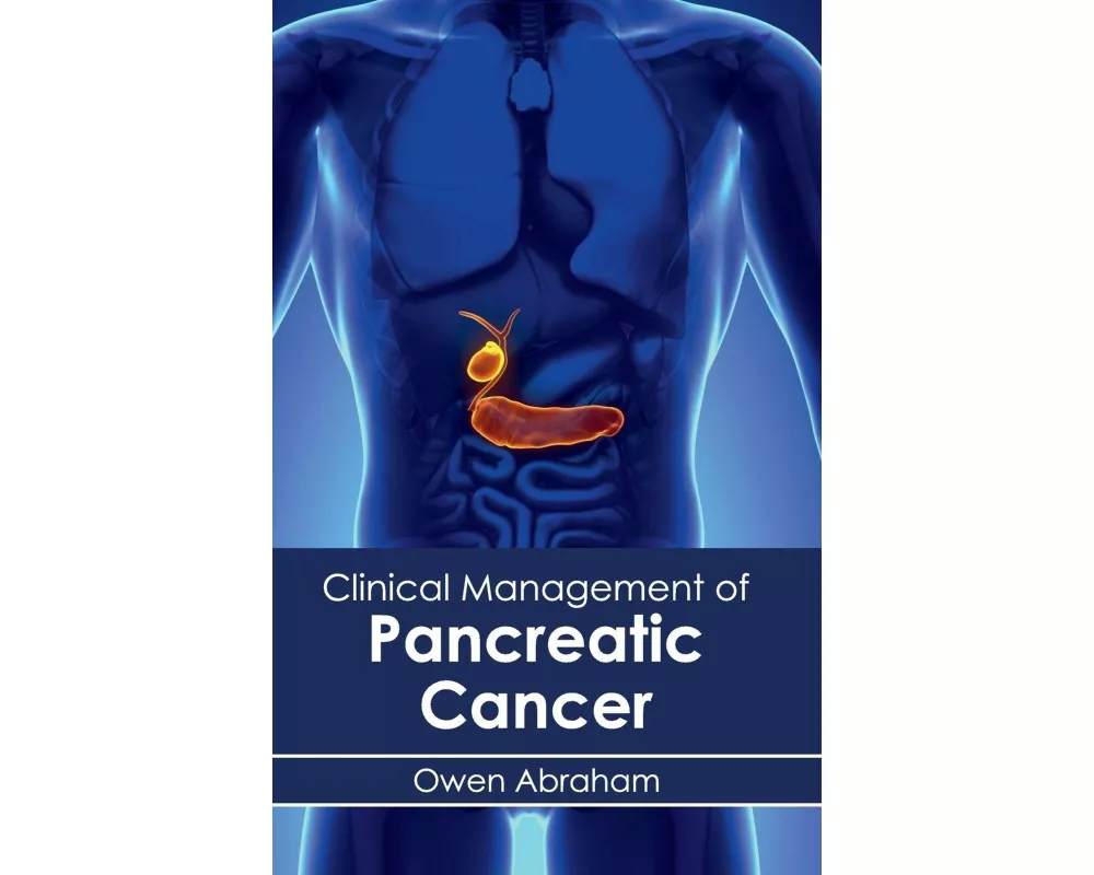 Clinical Management of Pancreatic Cancer