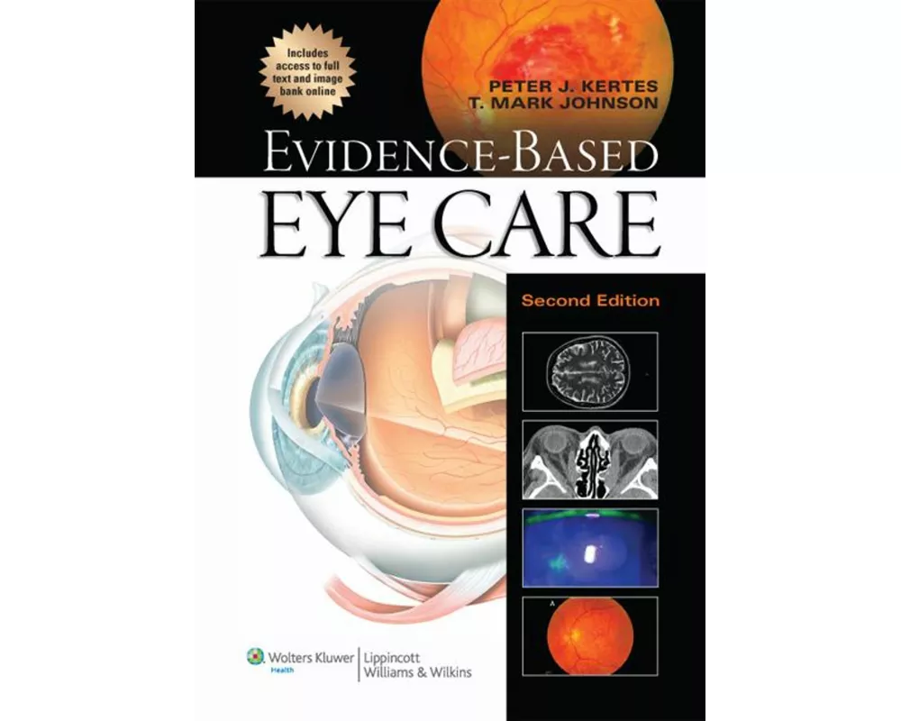 Evidence-Based Eye Care