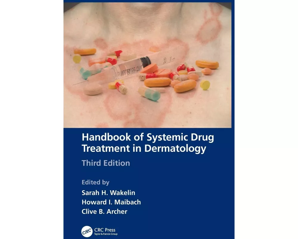 Handbook of Systemic Drug Treatment in Dermatology