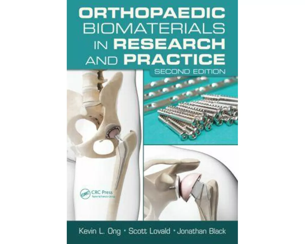 Orthopaedic Biomaterials in Research and Practice