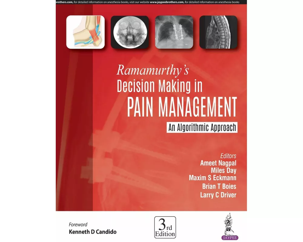 Ramamurthy's Decision Making in Pain Management