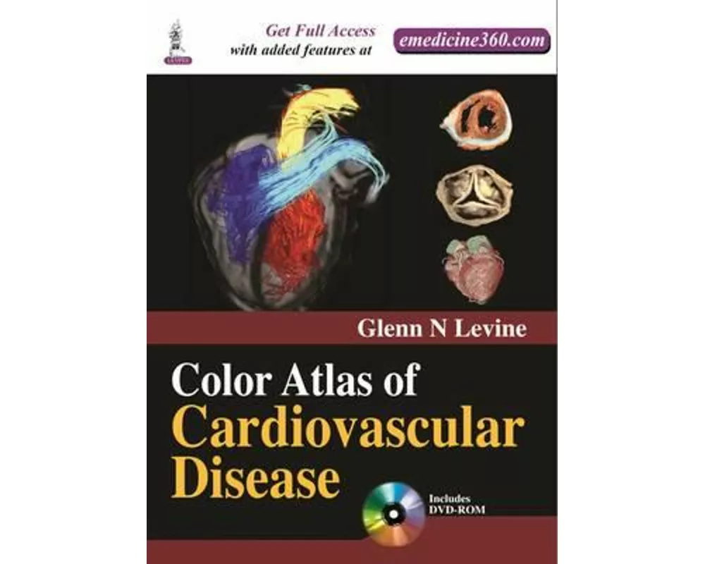 Color Atlas of Cardiovascular Disease
