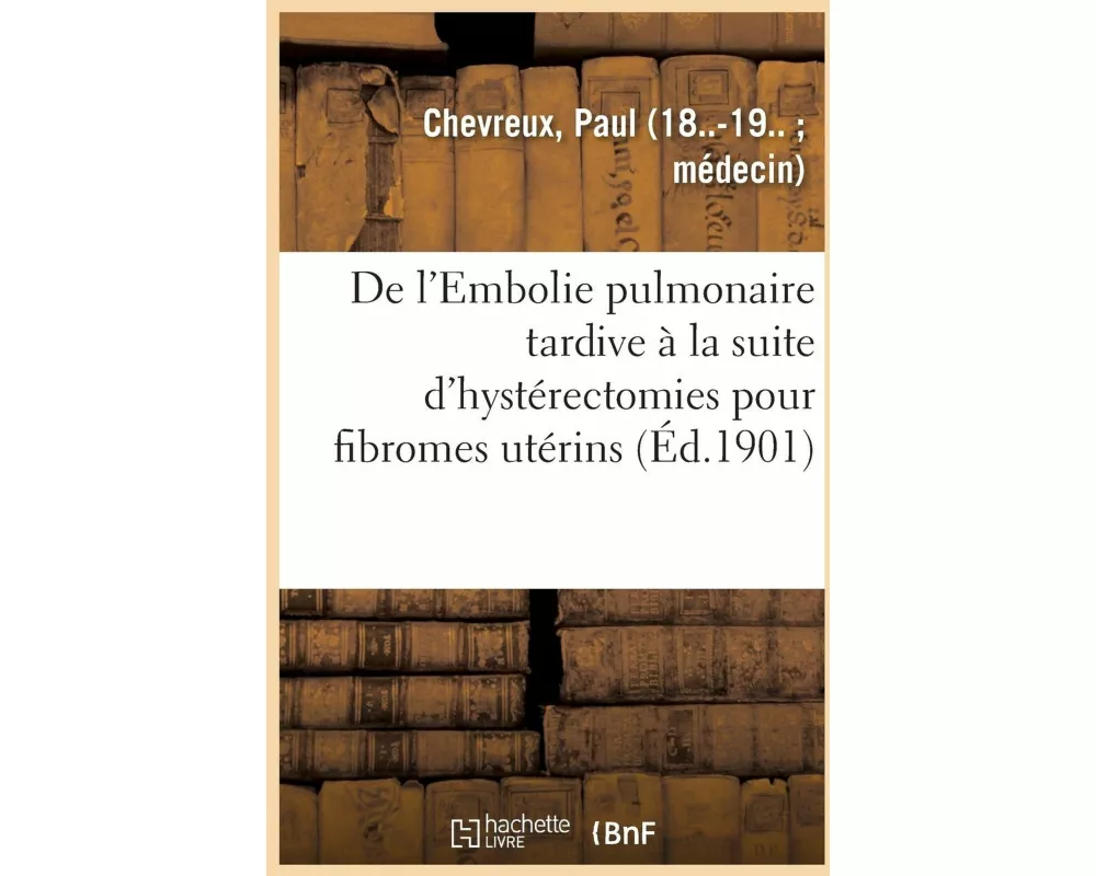 de l'Embolie Pulmonaire Tardive À La Suite d'Hystérectomies Pour Fibromes Utérins